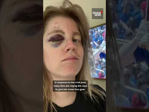Toronto Blue Jays fan hit in face by 110mph foul ball ⚾🧢 #TO #baseball #BoBichette
