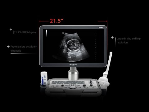 Mindray DC30 Full HD Ultrasound Machine