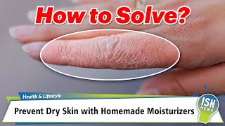 Prevent Dry Skin with Homemade Moisturizers