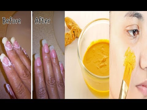 download lagu mp3 mp4 How To Remove Turmeric Stains From Hands And Nails, download lagu How To Remove Turmeric Stains From Hands And Nails gratis, unduh video klip How To Remove Turmeric Stains From Hands And Nails