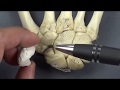 Lunate Anatomy and Osteology with Clinical Correlations and Side Determination