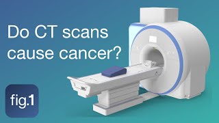 Do CT scans (computed tomography scans) cause cancer?