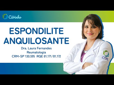 Espondilite Anquilosante | Rede Carinho