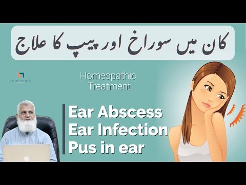 Ear Abscess & Ear Infection Remedies | Pus in Ear | Otitis Media Treatment