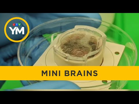 Researchers grow mini brain that plays Pong | Your Morning