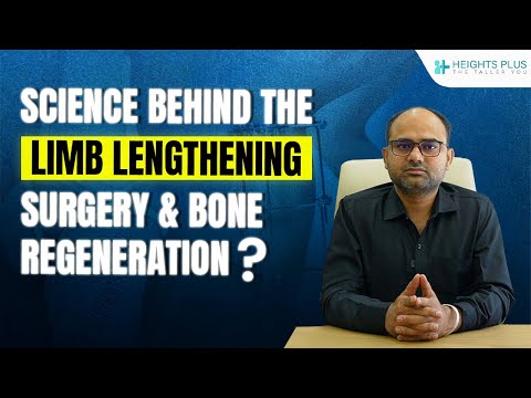 Science Behind Limb Lengthening Surgery & Bone Regeneration