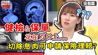 胃鏡檢查不可少？手術險超重要！「切除息肉」也可申請理賠？！【#醫師好辣】20210503 完整版 健檢、保單花在刀口上 EP1142 宋明樺 洪素卿