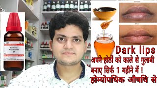 Dark lips Black lips ! Homeopathic medicine for Dark lips ? causes ! tips !