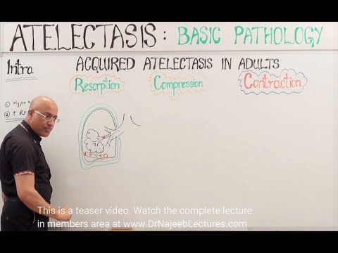 Atelectasis | Resorption, Compression and Contraction - YouTube