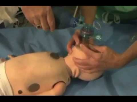 Bag Valve Mask (BVM) Ventilation in Pediatrics
