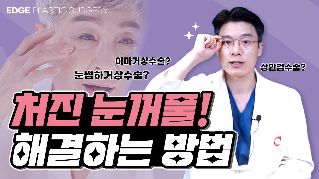 처진 눈꺼풀을 해결하는 3가지 방법! 상안검수술 눈썹하거상술 이마거상술 중에서 뭘 해야 하나요? 처진 눈꺼풀을 해결하는 3가지 방법! 상안검수술 눈썹하거상술 이마거상술 중에서 뭘 해야 하나요? 눈성형