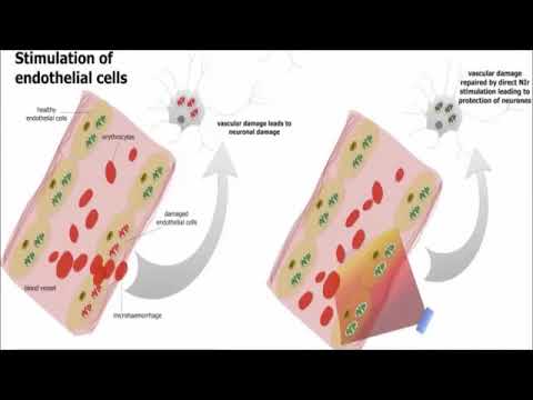 Near Infrared light for reversing Alzheimer's