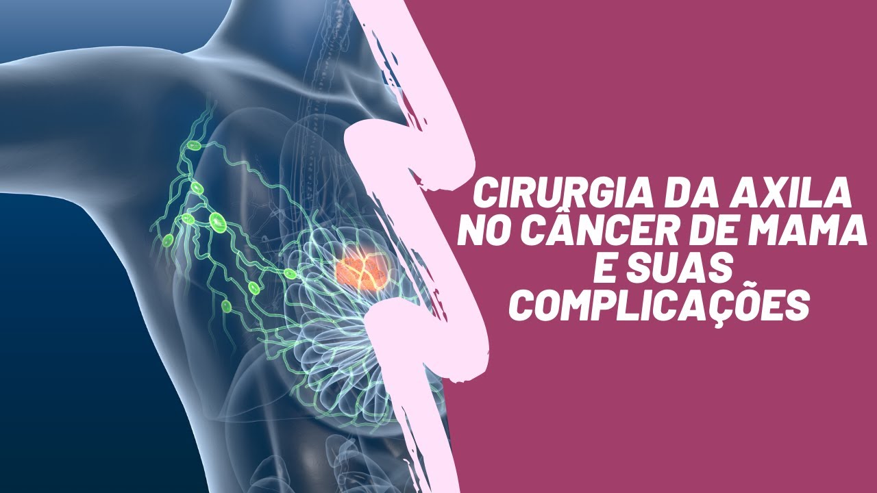 Douglas Soltau Gomes-12