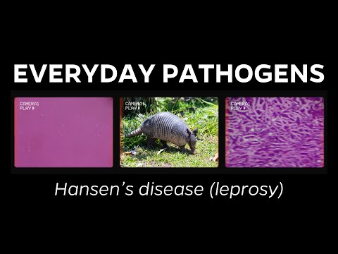 What is leprosy (a.k.a. Hansen's disease)?