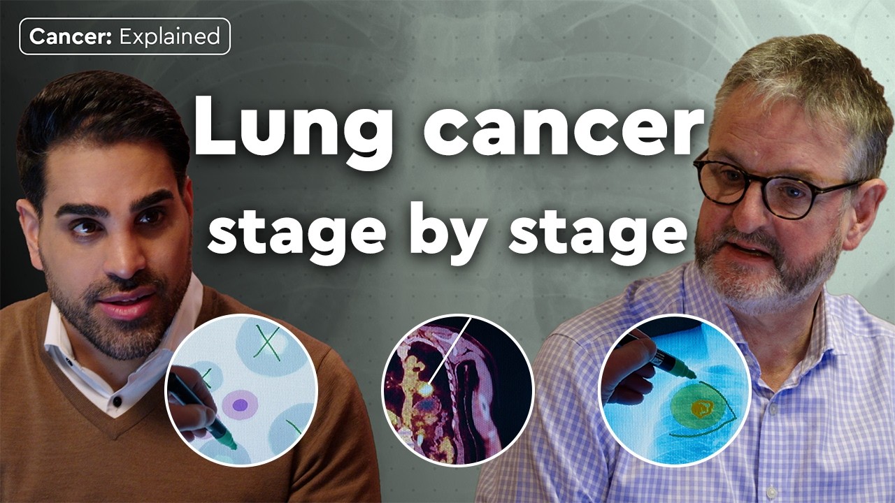 What happens in every stage of lung cancer? | Cancer: Explained | Macmillan Cancer Support