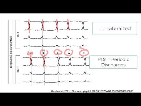 Rhythmic and Periodic Patterns