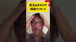 6週間、赤玉ねぎを頭に塗った結果｜5本生えたけど微妙…