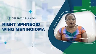 Right Sphenoid Wing Meningioma | Dr. Ravi Suman Reddy