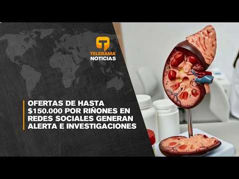 Ofertas de hasta $150.000 por riñones en redes sociales generan alerta e investigaciones