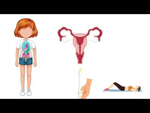 How to use vaginal suppositories. - Pharmaceutical Division BMA (กองเภสัชกรรม สำนักอนามัย)