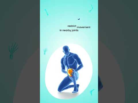 Symptoms of Bone Deformity