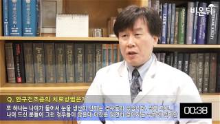 [기획취재] 안구건조증의 치료방법