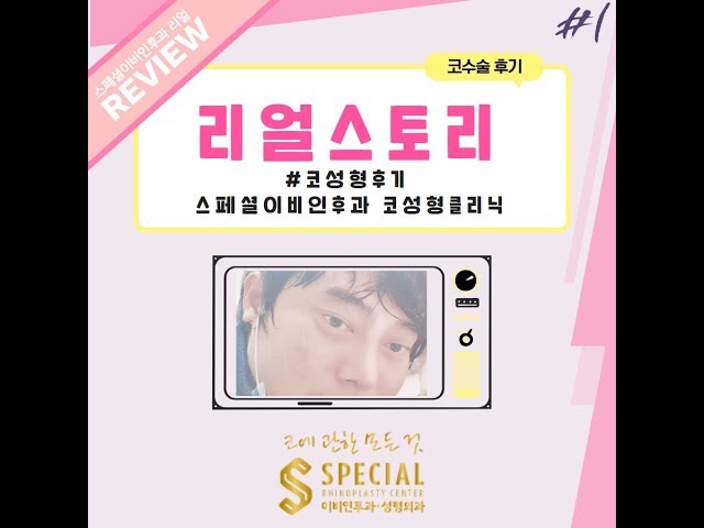 스페셜코성형클리닉 스페셜 이비인후과_전후사진&후기_동영상후기 스페셜코성형클리닉 스페셜 이비인후과_전후사진&후기_동영상후기