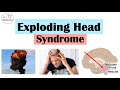 Exploding Head Syndrome (Loud Noises When Falling Asleep) | Triggers, Symptoms, Diagnosis, Treatment