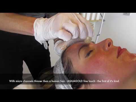 AQUAGOLD Fine Touch 'Golden Cocktail Facial' Treatment London