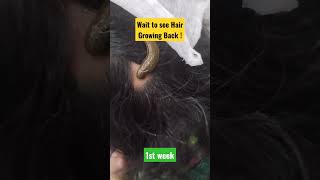 Hair Growing Back on Bald Patch !