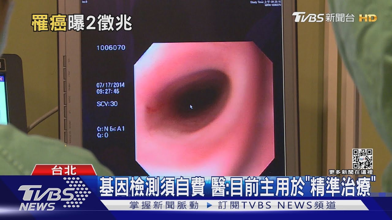 直腸癌難辨曾透露排泄稀黏　余苑綺：誤認腹瀉