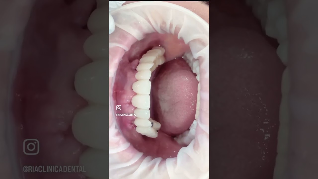 Mariel Itzayani Torres López-49