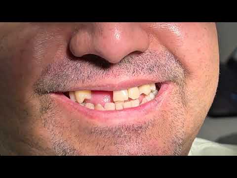 Joel Alejandro Sánchez Zúñiga-7