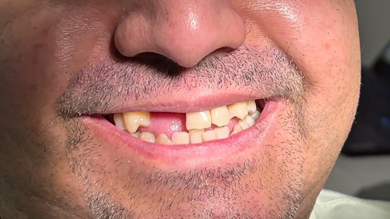 Joel Alejandro Sánchez Zúñiga-7