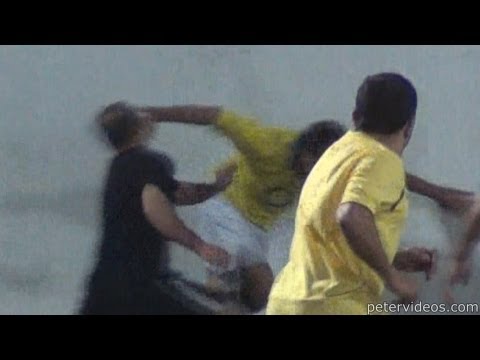 Punched in the Face!!!