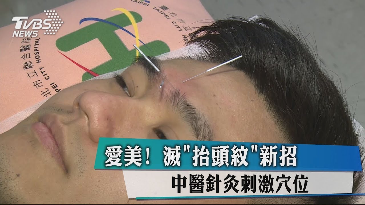 愛美!滅「抬頭紋」新招 中醫針灸刺激穴位