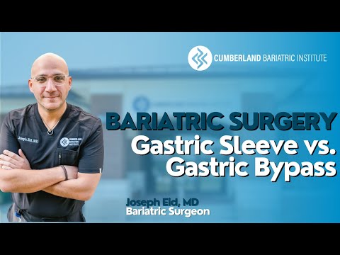 Gastric Sleeve vs. Gastric Bypass