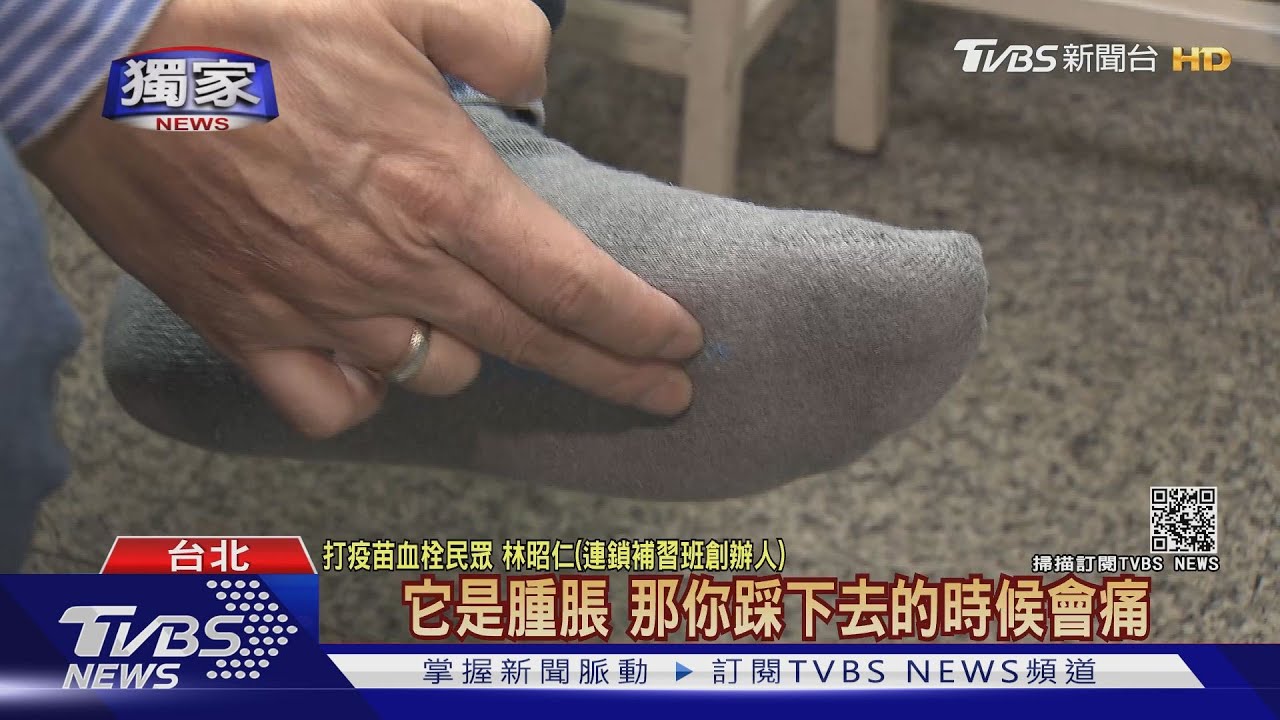 男打AZ疫苗後腳痛6天竟是「腦加腳血栓」 醫認證:AZ疫苗誘發