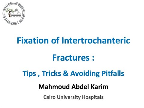 Fixation of Intertrochanteric Fractures Tips , Tricks & Avoiding Pitfalls