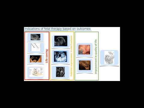 ISPD Virtual Education Series - Session 3: Debate 1