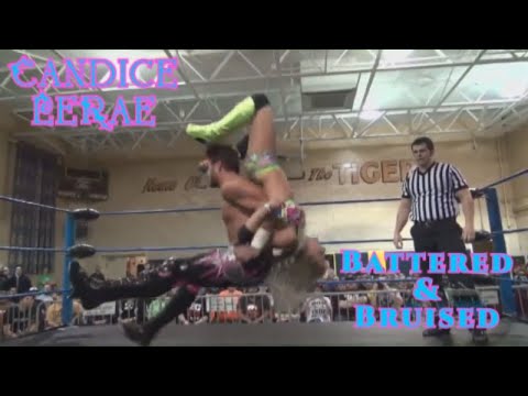 Candice LeRae ~ Battered & Bruised