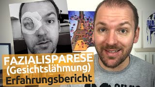 Gesichtslähmung – Diagnose: Fazialisparese | Ursache, Behandlung, Folgen | Thomas Stradner