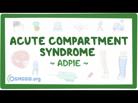 Chronic obstructive pulmonary disease Nursing Process