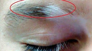 how to get rid of grey hair in eyebrows
