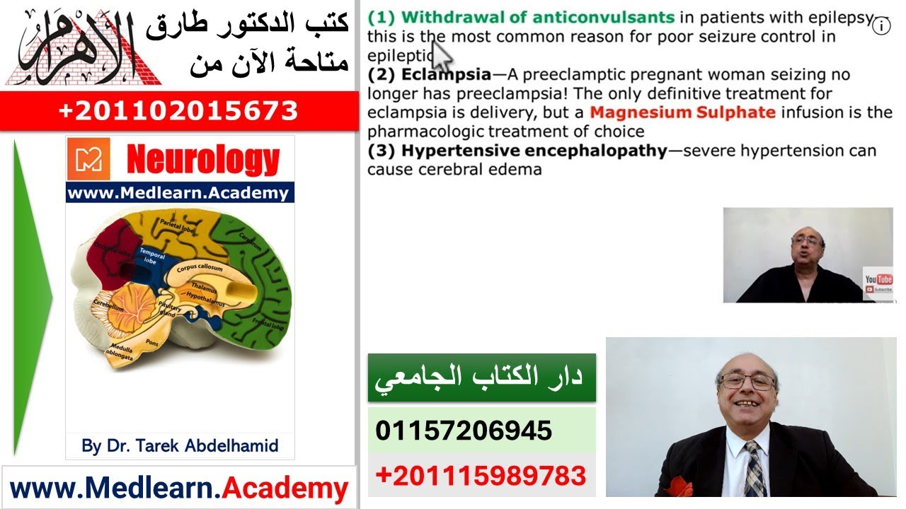 Epilepsy (4) #usmle #internal_medicine #cme #medicaleducation #ecg  #محاضرات_باطنة #medical