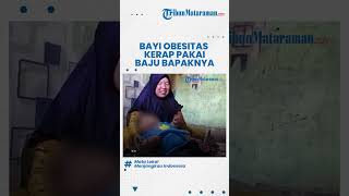 Bayi Obesitas Kerap Pakai Baju Bapaknya, Lantaran Ukuran Badannya Hampir seperti Orang Dewasa