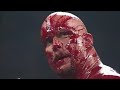 Attitude Era Edition (Episode 1):Kane Stone Cold Steve Austin Blood-Bath Segment!