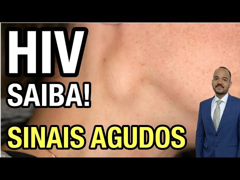 Early Symptoms of HIV - Acute Retroviral Syndrome