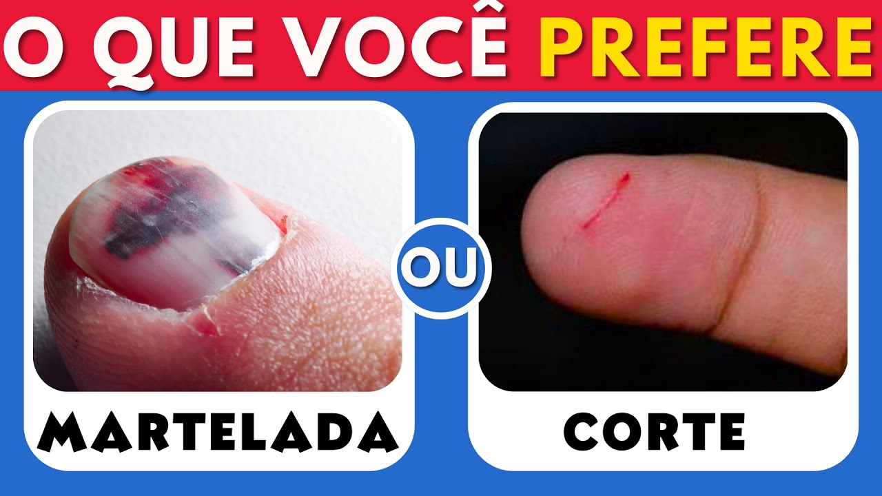O Que Você Prefere!? 😱😨 PREPARADO?! - 30 Escolhas Bem DIFÍCEIS!