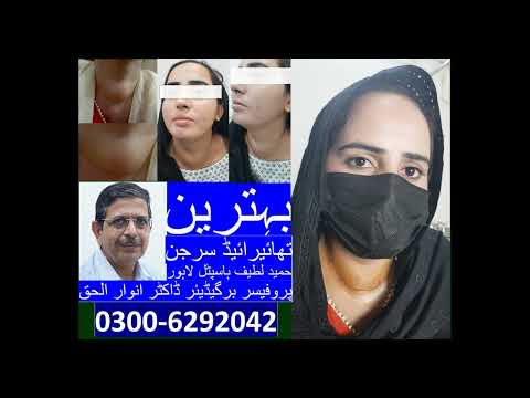 Thyroidectomy patient comments after surgery